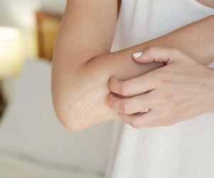 Could softened water help dry skin in the winter?